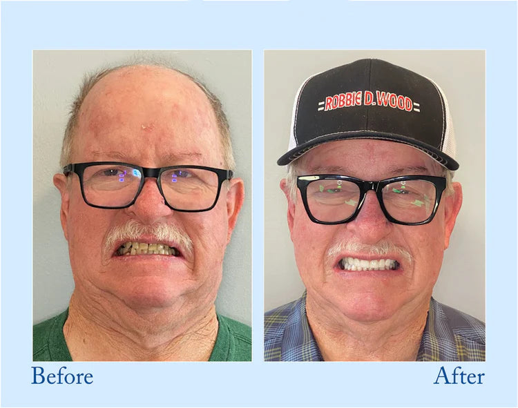 đ BBOJI⢠Fluoride-Free Hydroxyapatite Toothpaste đ Naturally Brighter Smiles