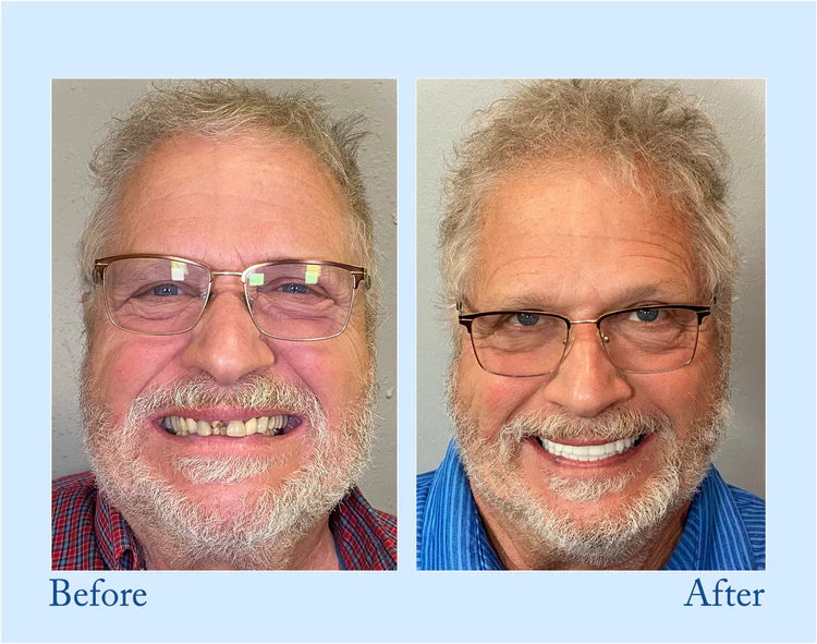 đ BBOJI⢠Fluoride-Free Hydroxyapatite Toothpaste đ Naturally Brighter Smiles