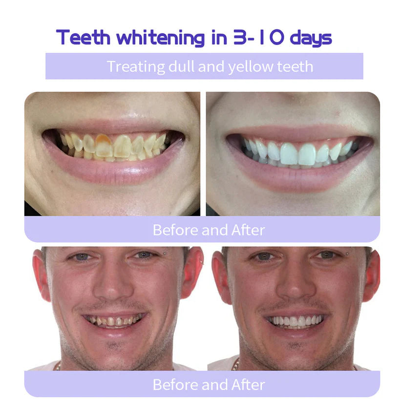 đ BBOJI⢠Fluoride-Free Hydroxyapatite Toothpaste đ Naturally Brighter Smiles