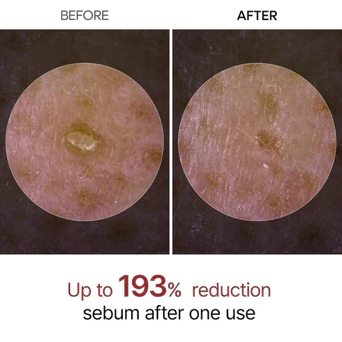 🔥 "Gentle Exfoliator Glow Rice Ampoule – Fits All Skin Types, Boosts Radiance"