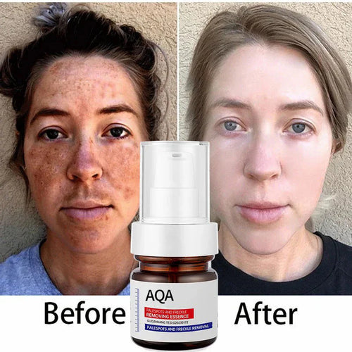 đż"Fade Dark Spots, Boost Glow â The 5-Second Brightening Serum"
