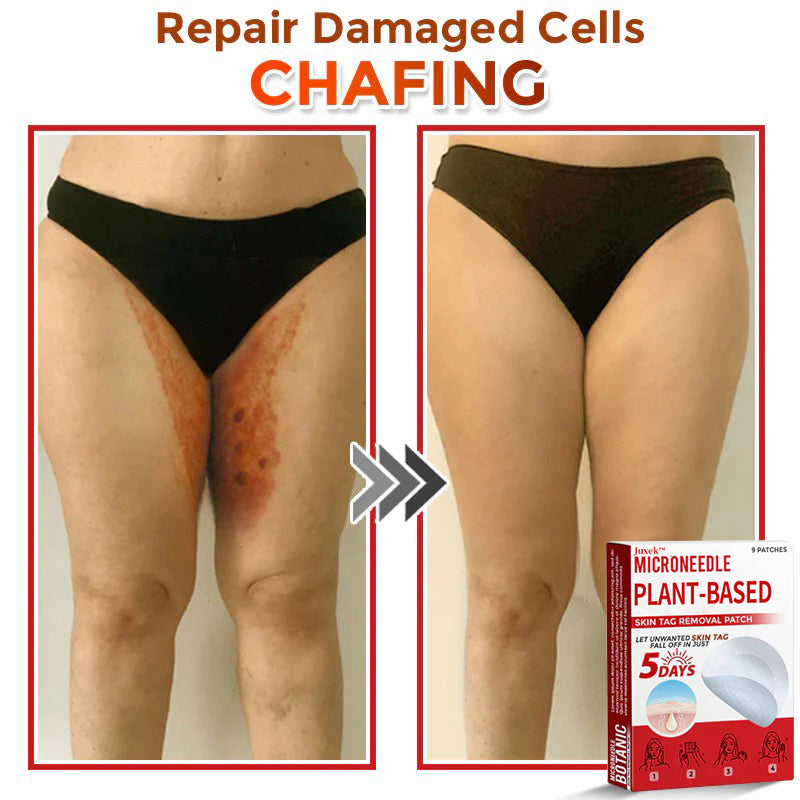 💯Juxek™ MicroNeedle Plant-based Skin Tag Removal Patch 🇺🇸 Made in the USA