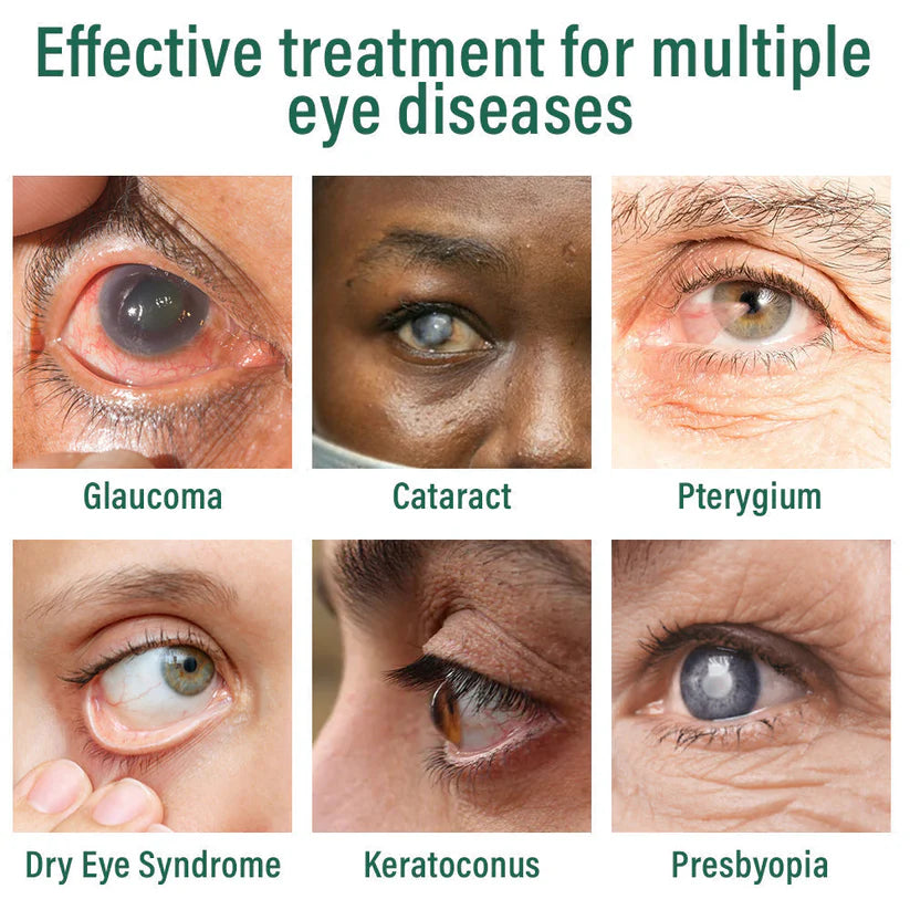 LOVILDS™ Nano Eye Drops Serum ✅FDA Approved(Suitable for presbyopia, dry eye syndrome, glaucoma, and cataracts) 👀
