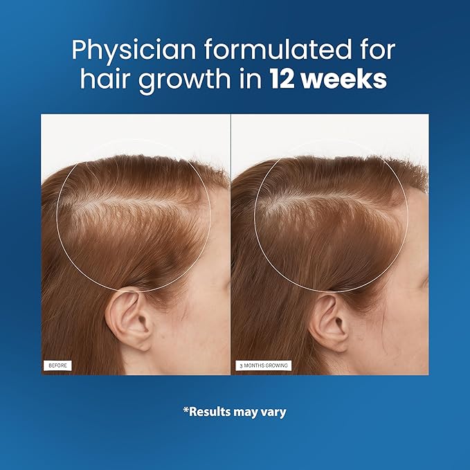 Be LOVILDS Advanced Rosemary Hair Growth Roll-On Serum | Clinically Proven Hair Regrowth Treatment