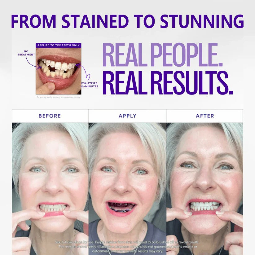 Final 3 Hours: 60%OFFđ„Daily Use Teeth Whitening Powder | Vegan & Peroxide-Free | Deep Stain Removal for Brighter Smiles