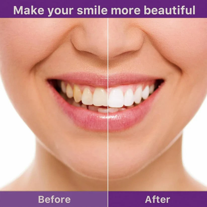 Final 3 Hours: 60%OFFđ„Daily Use Teeth Whitening Powder | Vegan & Peroxide-Free | Deep Stain Removal for Brighter Smiles