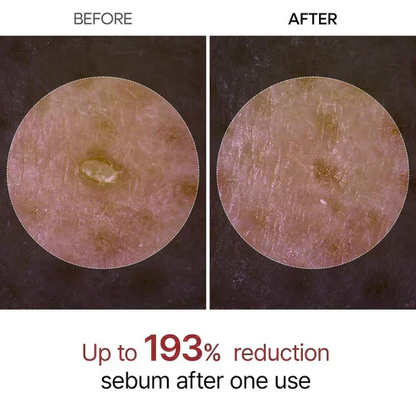 🔥 "Gentle Exfoliator Glow Rice Ampoule – Fits All Skin Types, Boosts Radiance"