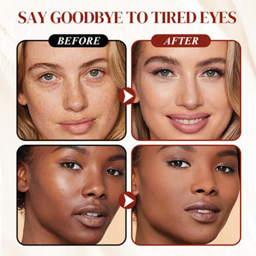 AQA™ Under Eye Concealer Cream – Brighten, Cover Dark Circles & Refresh Tired Eyes