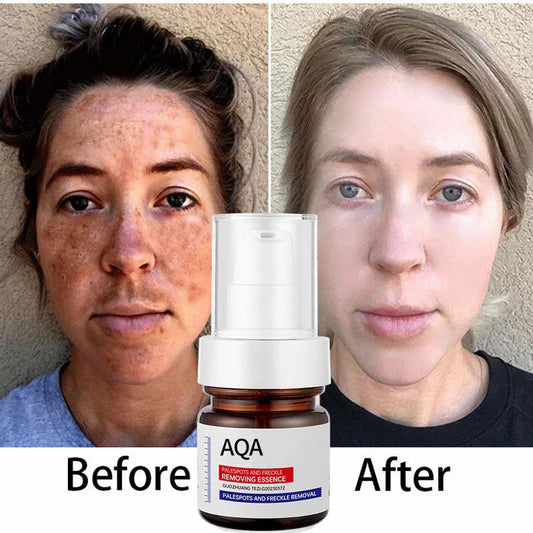 🌿"Fade Dark Spots, Boost Glow — The 5-Second Brightening Serum"