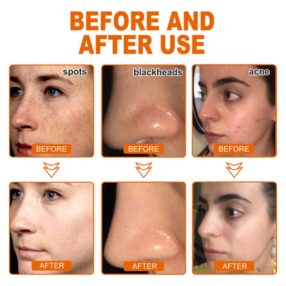 🔥[Official Brand Store] BBOJI™ Herbal Spots Peel-Off Facial Mask