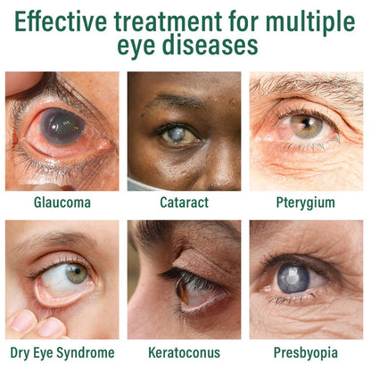 LOVILDS™ Nano Eye Drops Serum ✅FDA Approved(Suitable for presbyopia, dry eye syndrome, glaucoma, and cataracts) 👀