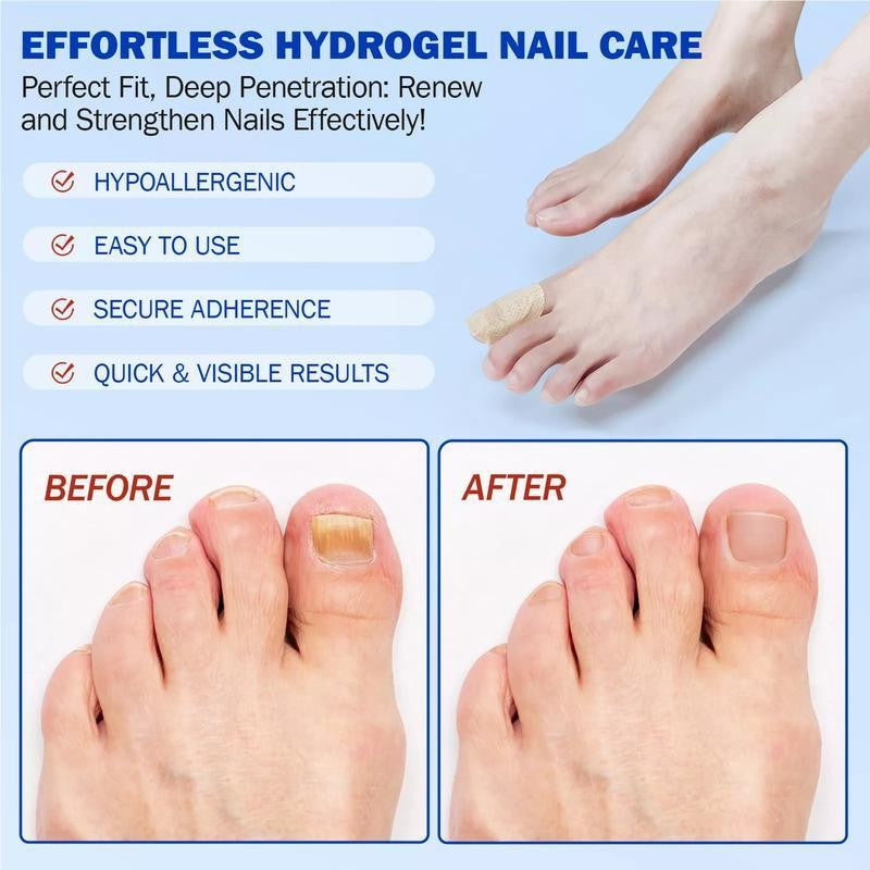 NESLEMY® Fungal Nail Care Patches (21pcs/Box) – Targets Nail Fungus & More 💫Nail Health Set