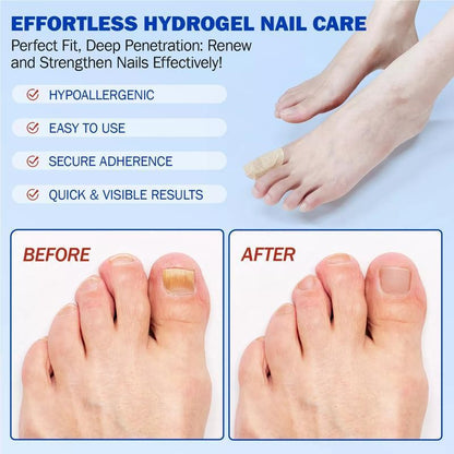 NESLEMY® Fungal Nail Care Patches (21pcs/Box) – Targets Nail Fungus & More 💫Nail Health Set