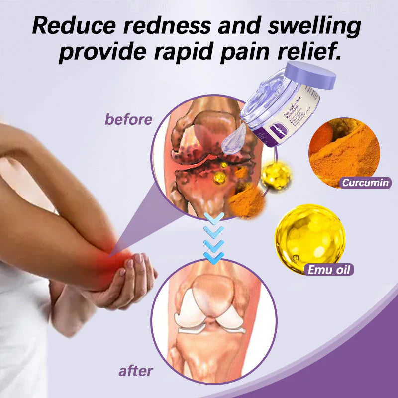 🔥🔥Ends Tonight: Get 60% OFF Before It’s Gone!🎁AQA™ Pain Relief Gel – With Turmeric & Emu Oil for Arthritis & Joint Support