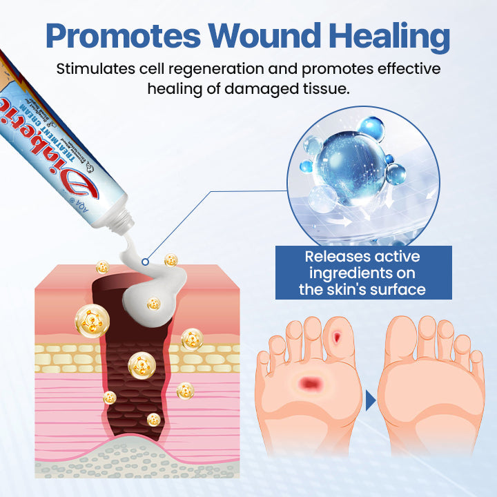 🔥🔥🔥Final 2 hours 60% OFF:AQA® Diabetic Foot Healing Cream