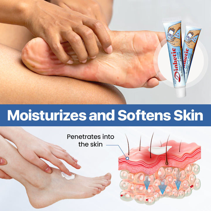 🔥🔥🔥Final 2 hours 60% OFF:AQA® Diabetic Foot Healing Cream