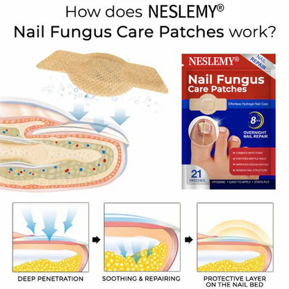 NESLEMY® Fungal Nail Care Patches (21pcs/Box) – Targets Nail Fungus & More 💫Nail Health Set