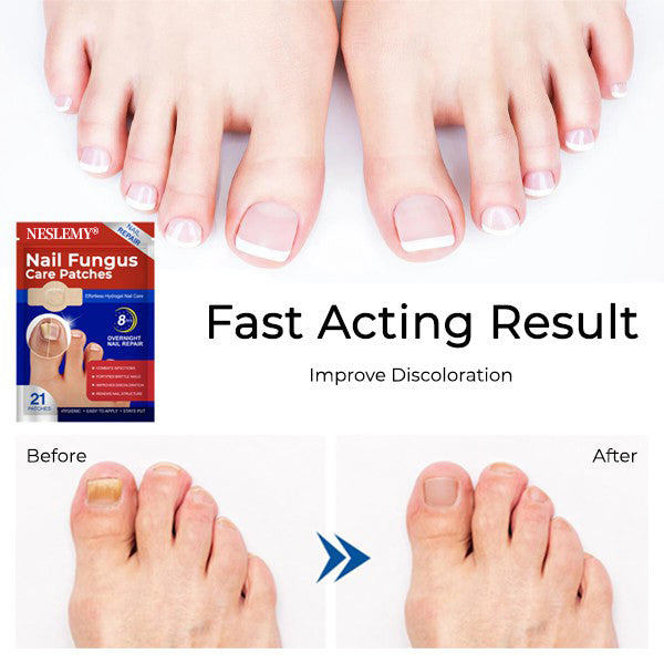 NESLEMY® Fungal Nail Care Patches (21pcs/Box) – Targets Nail Fungus & More 💫Nail Health Set