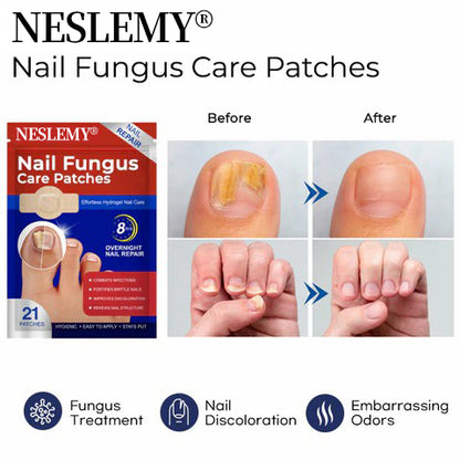 NESLEMY® Fungal Nail Care Patches (21pcs/Box) – Targets Nail Fungus & More 💫Nail Health Set