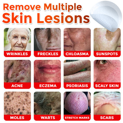 💯Juxek™ MicroNeedle Plant-based Skin Tag Removal Patch 🇺🇸 Made in the USA