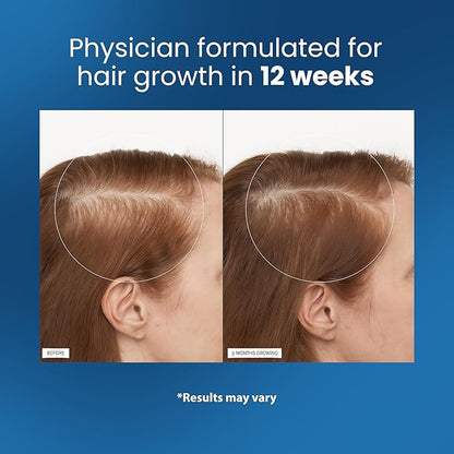 Be LOVILDS Advanced Rosemary Hair Growth Roll-On Serum | Clinically Proven Hair Regrowth Treatment
