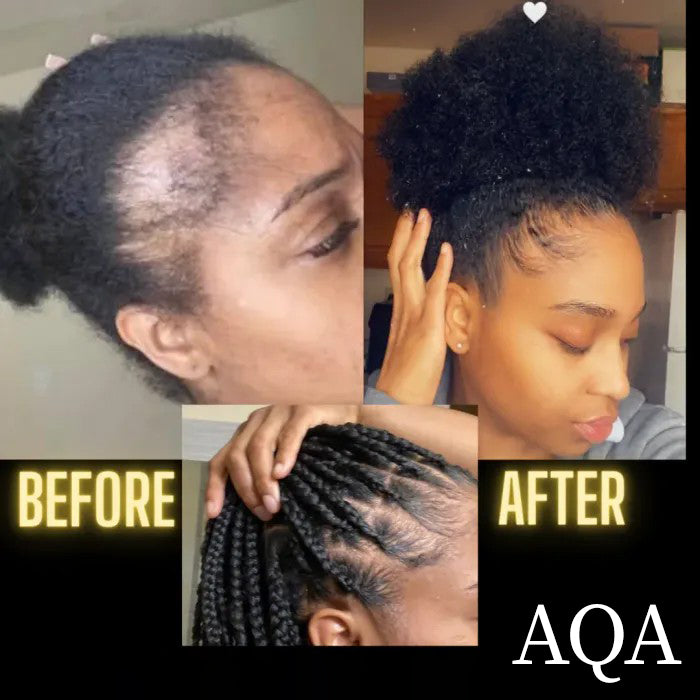 AQA™ BALM- Stimulating Scalp and Hair Balm